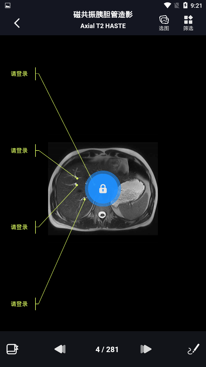 影像解剖图谱电子版 v3.9.7