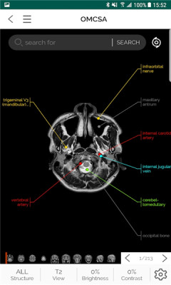omcsa医学软件 v1.4.6