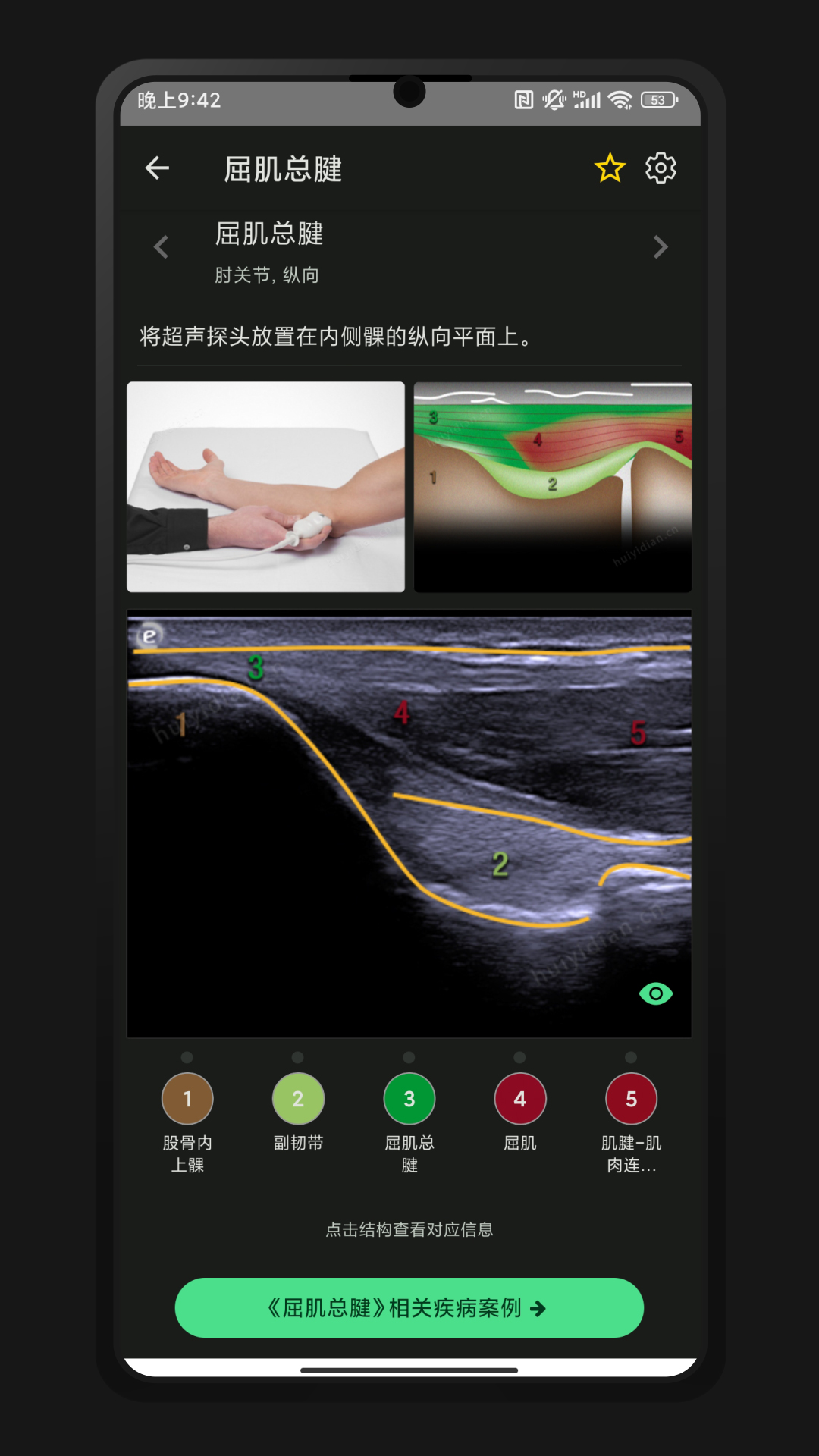 超声智学app安卓版 v2.0.0